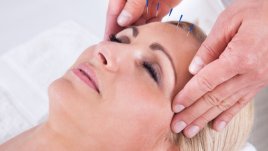 Акупунктура по време на бременност