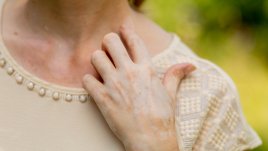 5 маски, които намаляват пигментните петна