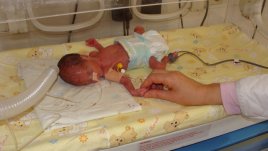 Спасиха 3 недоносени бебета по 800 грама в Бургас