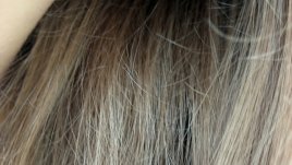 11 причини за косопад