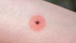 5 съвета, които ни пазят от кърлежи