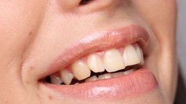 Вредни навици, които предизвикват поява на бръчки