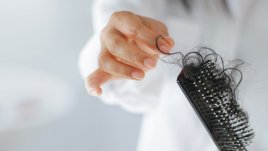 Как да предотвратите загуба на коса?