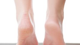 Витамини и минерали при напукани пети