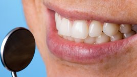 4 заболявания, свързани със зъбните инфекции