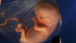 Преди аборт ти дават да чуеш сърцето на бебето