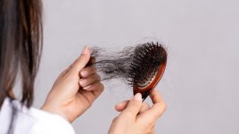 5 билки, помагащи в борбата с косопада