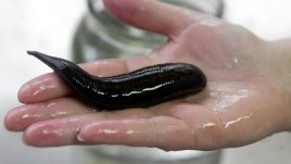 Терапия с пиявици помага при редица здравословни проблеми