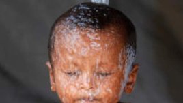 Закаляване на новородено и кърмаче