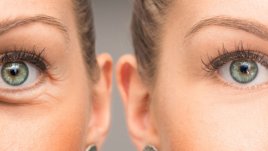 Кои са най-добрите етерични масла при подпухнали очи