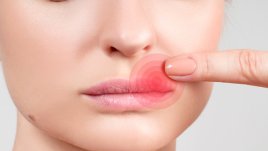 Натурални лекове при херпес