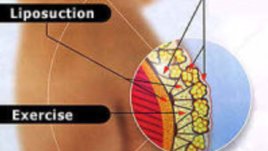 Кажете сбогом на целулита 