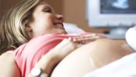 Колко струва раждането?...