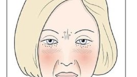 Имате ли „глутеново лице“