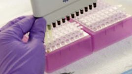 Световният ден за борба с лимфом е 15 септември