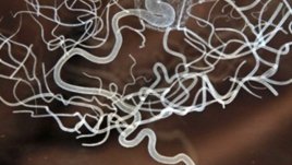 Как да изгоним от главата си досадните мисли?