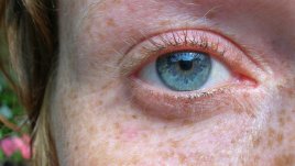 Как да намалите появата на луничките и кафявите петна