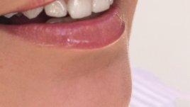 Храни, които се грижат за здравето на венците и зъбите