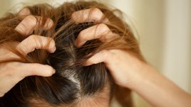 Най-голямата грешка, която правите с шампоаните против пърхот 