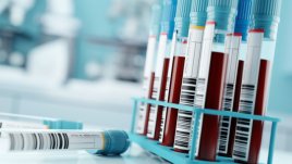 Колко време не трябва да се храните, ако правите изследвания на гладно