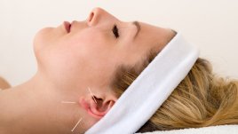 7 здравословни ползи от акупунктурата