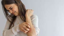 Неща, които влошават екземата 