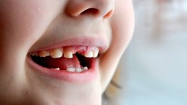 Поникване на млечни зъбки – какво е важно да се знае?