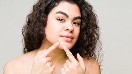 Как да се отървете от черните точки по брадичката