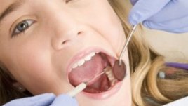 Какви стоматологични услуги заплаща Здравната каса