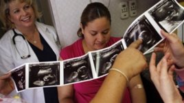 Сюрприз за началника: Бременна съм!