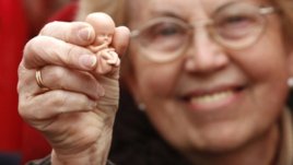 Семейните жени изпревариха тийнейджърките по аборти