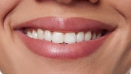 Стоматологични проблеми, които не трябва да отминаваме