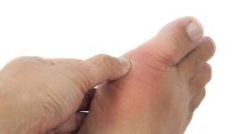 Високи нива на пикочна киселина и подагра