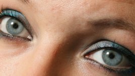 Какво ни разкриват очите за вътрешните заболявания?