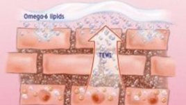 Омега-6 липиди – защо са важни за бебета със суха кожа?