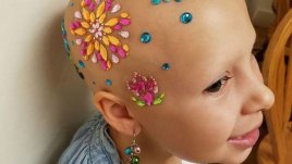 Когато болестта не може да надвие детската усмивка (галерия)