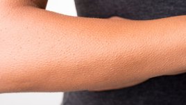 Какви странни неща правят телата ни от студ?