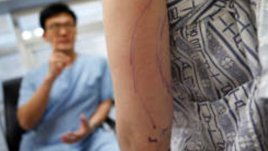 Започва кампания за профилактика на рака на дебелото черво