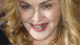 Едни от най-скъпите усмивки на шоубизнеса