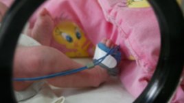 6000 бебета са се родили преждевременно през 2009 г. в България