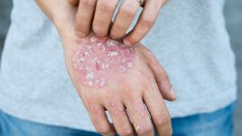 Болести, които мислите за заразни, но не са 