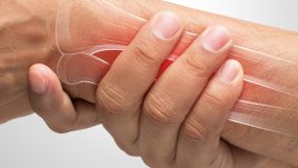 Храни, които помагат за бързо зарастване на счупени кости (галерия)