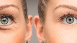 3 маски с кафе против подпухнали клепачи и торбички