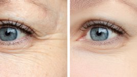 Нощни маски против бръчки около очите 