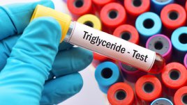 10 начина да намалите триглицеридите 