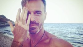 Ники Илиев за витилигото: Добавя цвят към личността