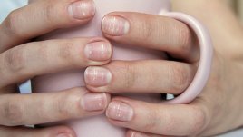 Признаци на бъбречни проблеми, които ноктите издават 