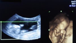 Важни витамини и аминокиселини за зачеване