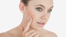 Естествено премахване на белези от акне