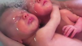 Близнаци, които не разбират, че са родени! (видео)